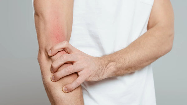 About Atopıc Dermatıtıs